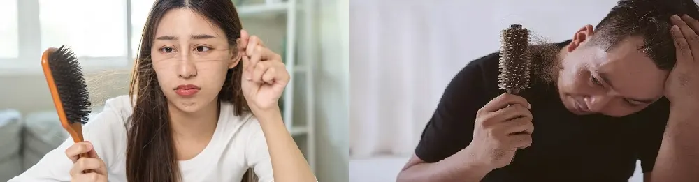 rambut rontok wanita-pria