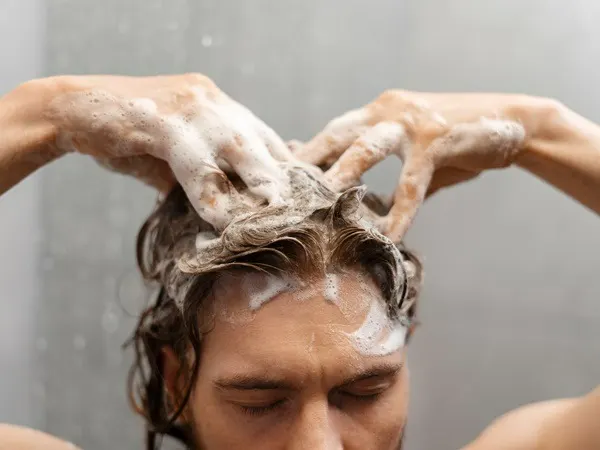 3 Faktor Kimia Ini Jadi Penyebab Rambut Berminyak