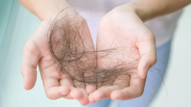 7 Solusi Medis Rambut Rontok yang Perlu Kamu Pahami